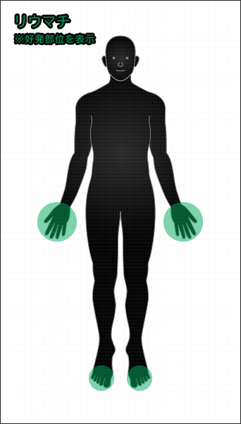 画像：リウマチ